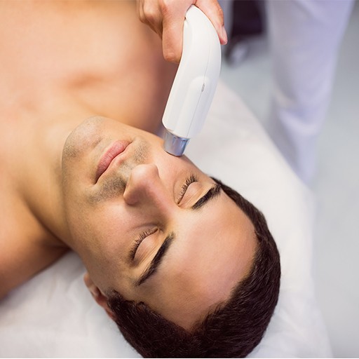 Lazer Epilasyon